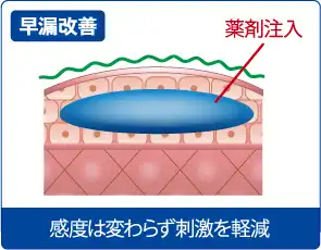 早漏改善効果