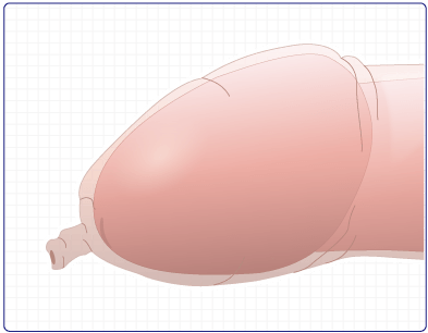 けい 治し 方 自力 ほう