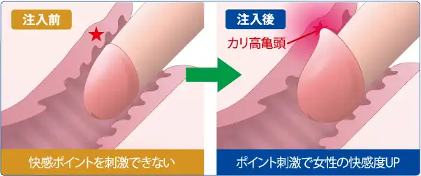 亀頭増大のメリット