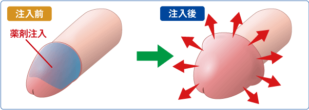 カリを大きくする