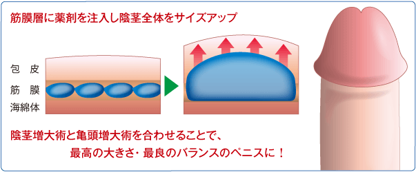 する ぺ ニス 大きく