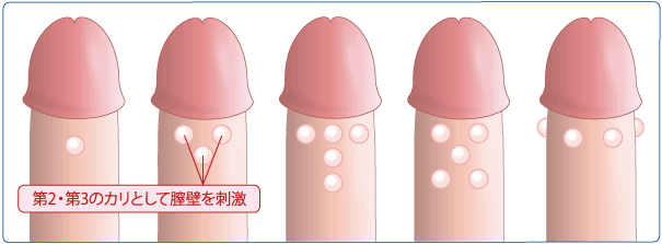 スリング 効果 に ペ