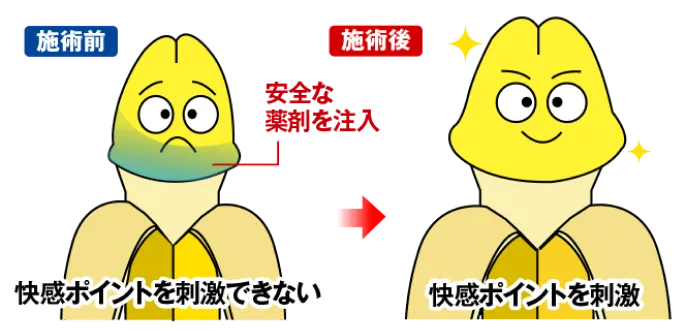 パートナーへ与える刺激増大