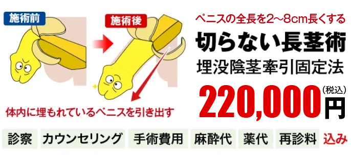 包茎も改善！切らない長茎術