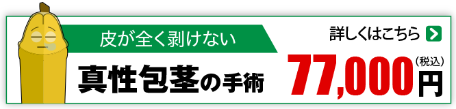 まったくむけないタイプ 真性包茎77,000円