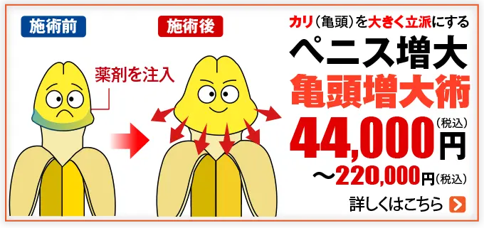 ペニス増大 亀頭増大術
                        44,000                        円