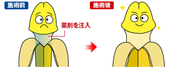 サオ（陰茎）を大きく逞しく