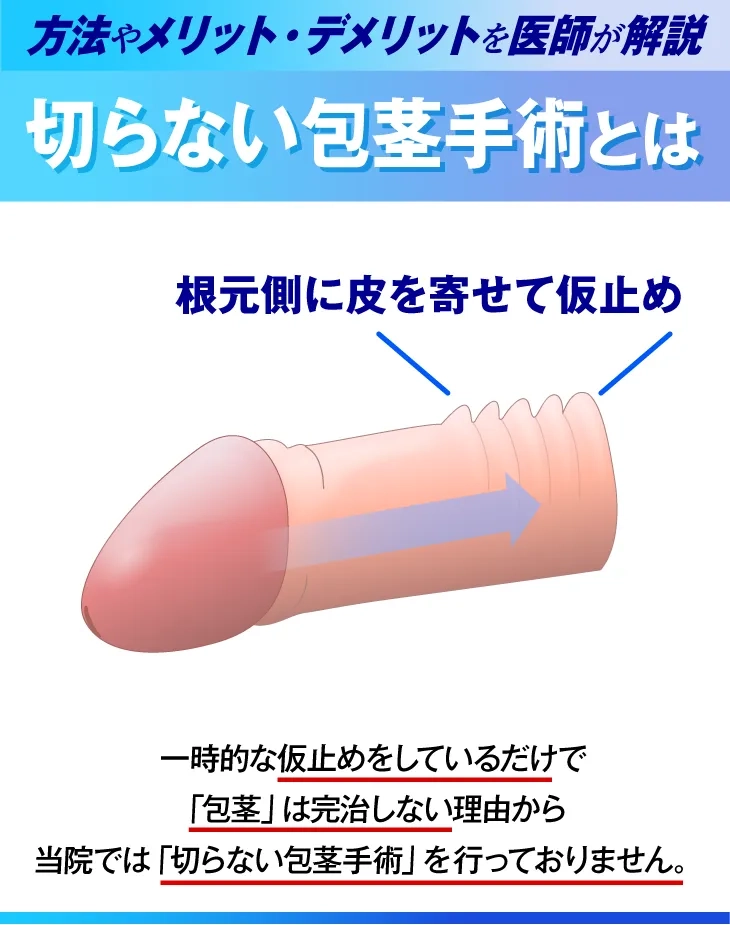 切らない包茎手術について