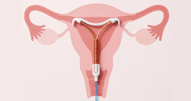 コンドームのイメージ