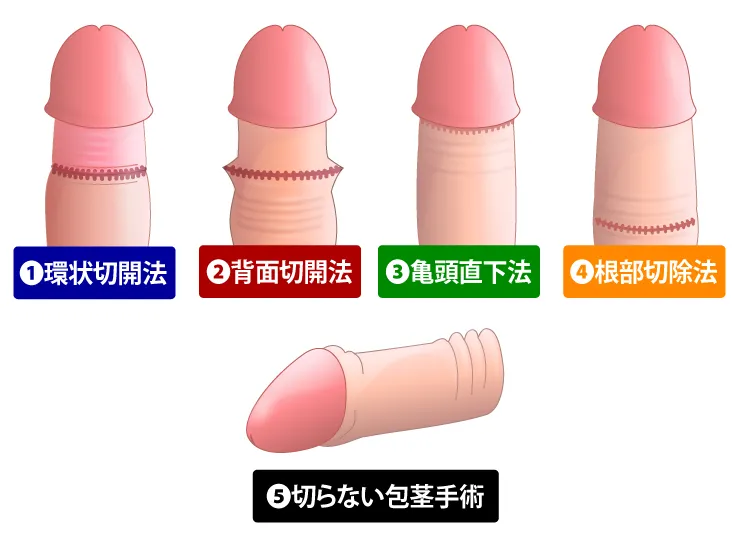 手術後の過ごし方やケアは?