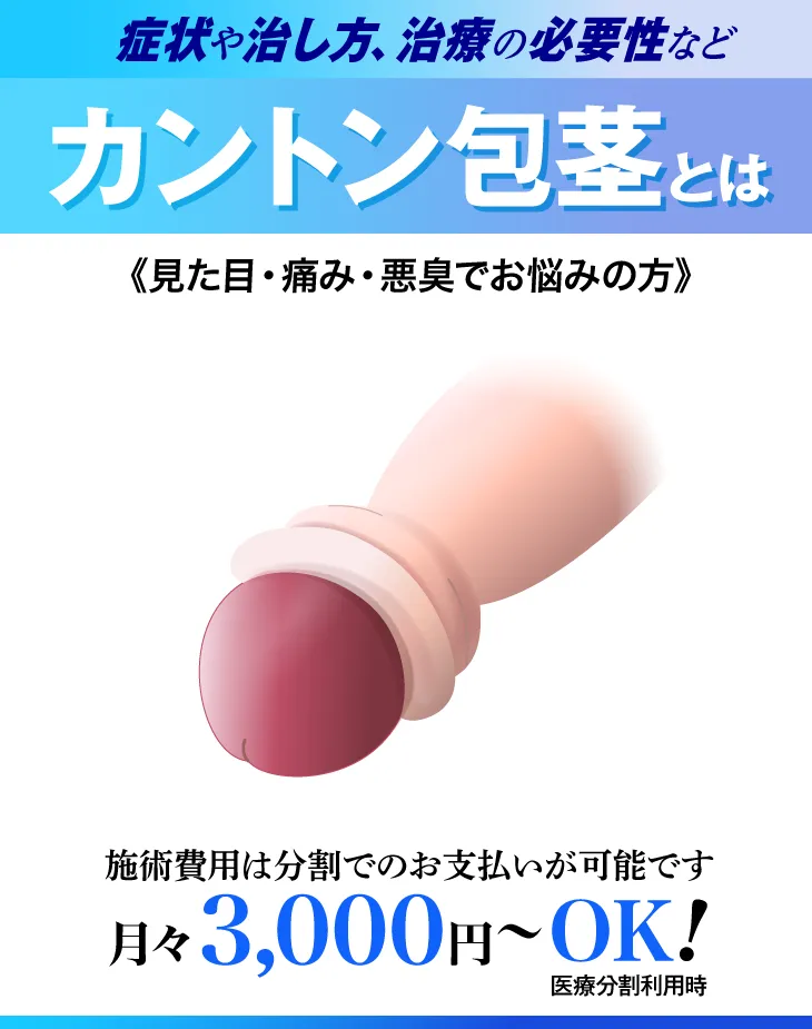 カントン包茎について