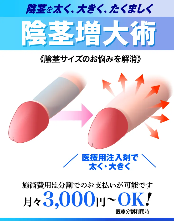 陰茎増大術について