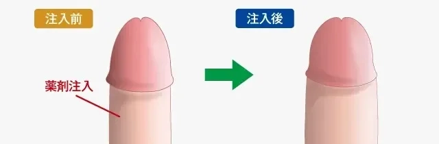 ペニス増大で大きく逞しく