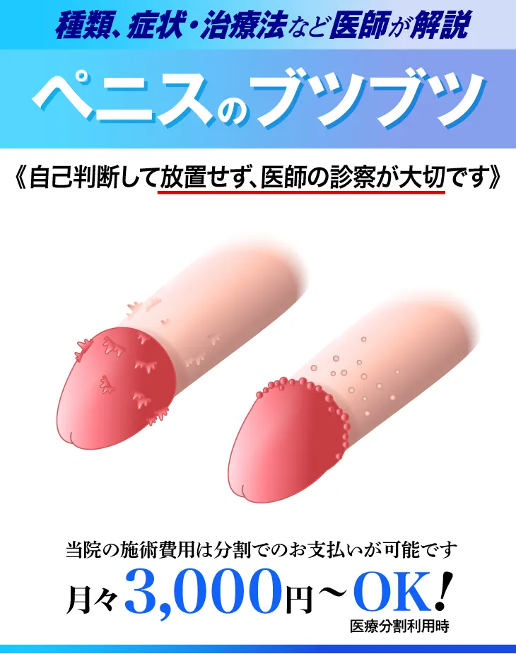 ペニスのブツブツ除去について