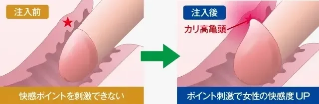 亀頭増大で女性も大満足