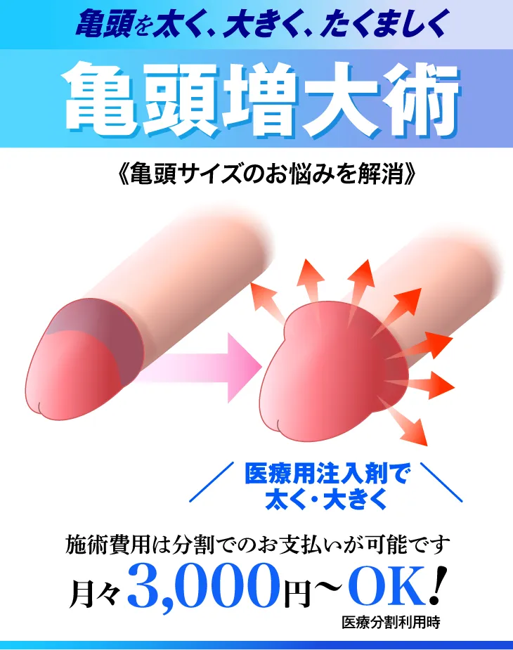 亀頭増大術について