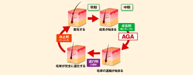 毛周期サイクル【AGA】