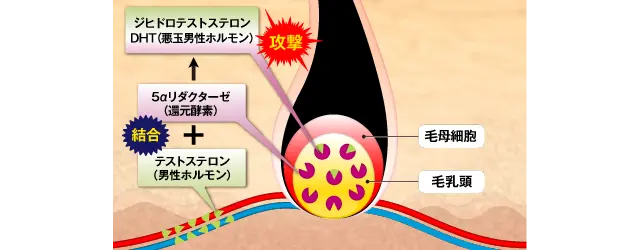 【AGA】抜け毛のメカニズム