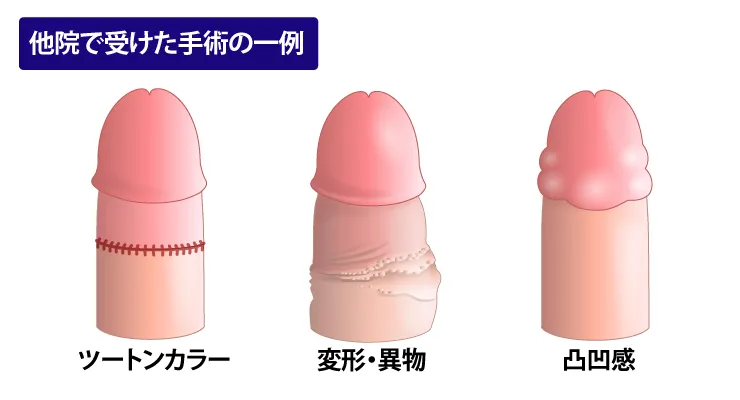 他院で手術・治療を受けたイメージ