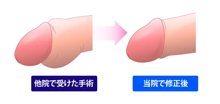腫れや変形のイラスト